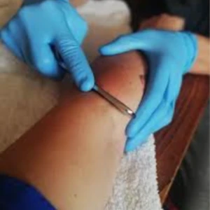 Elbow Application