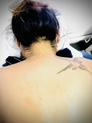 Neck Treatment