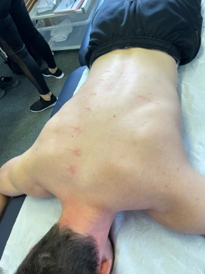 Back Treatment