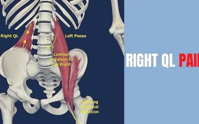 Psoas and quadratus lumborum