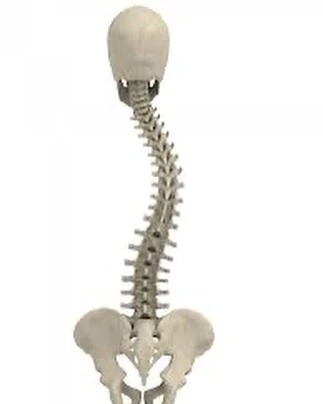 Scoliosis