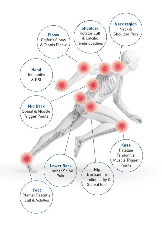 Pathologies