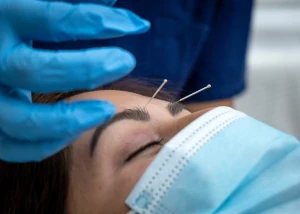 Pricing List for Acupuncture
