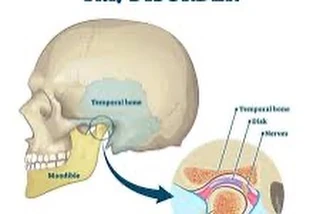 TMJ anatomy