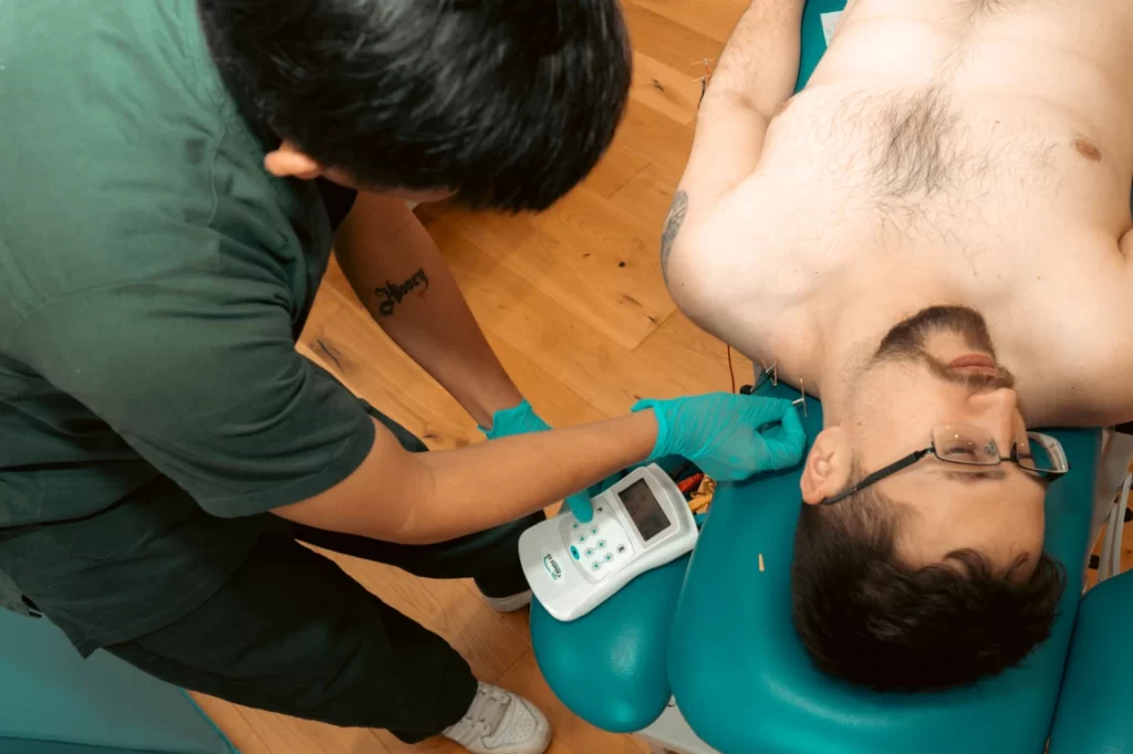 Acupuncture