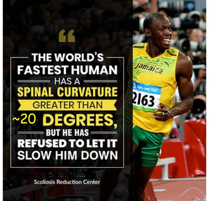 Scoliosis and Usain Bolt: What It Means for Your Back Pain