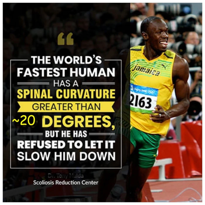 src-104483-bolt_03 Graphic about Usain Bolt's spinal curvature
