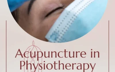 Acupuncture in Physiotherapy: How It Works and What It Treats