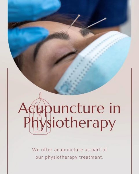 Acupuncture in Physiotherapy: How It Works and What It Treats